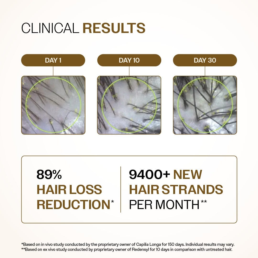 Advanced Hair Growth Serum. with Redensyl, Rosemary, Rice Water (30ml)                                                   ⭐4.8 | 1.2K Reviews