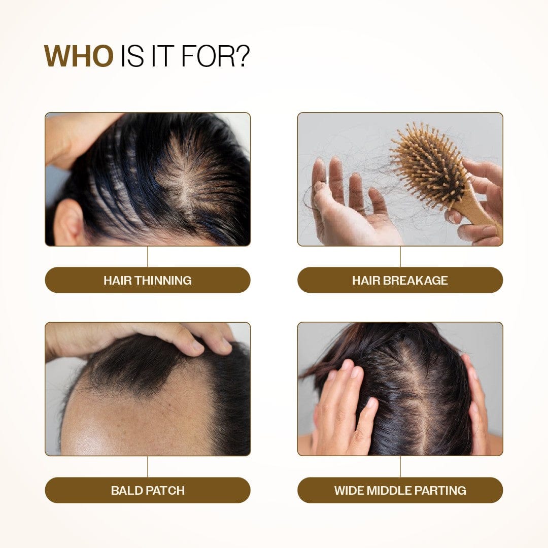 Advanced Hair Growth Serum. with Redensyl, Rosemary, Rice Water (30ml)                                                   ⭐4.8 | 1.2K Reviews